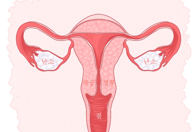 난소암, 난소낭종…난소 건강과 여성호르몬의 관계