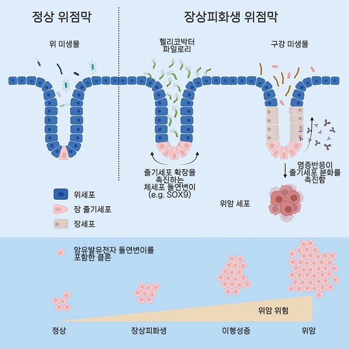 장상피회생 위암 진행 관여하는 유전자 변이 규명｜출처: 서울대학교병원