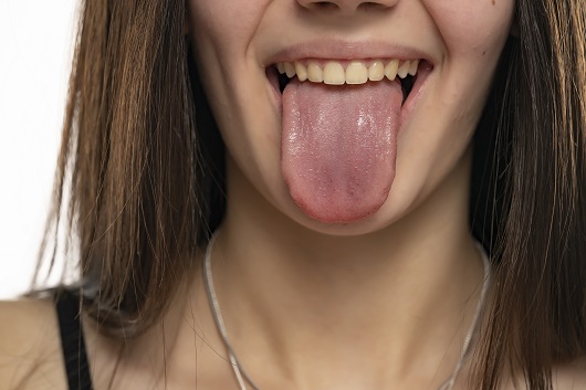 건강한 혀는 붉은빛이 돌지만 건강하지 않은 혀는 지도 모양 등을 보인다ㅣ출처: 게티이미지뱅크