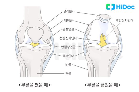 스쿼트 중 ‘뚝’소리…계속 운동해도 될까? [인터뷰]