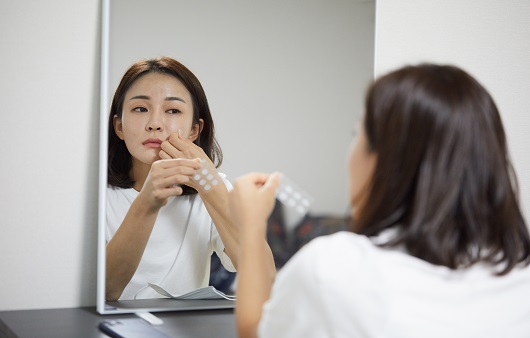 여드름 패치를 사용할 때는 그 안에 포함된 성분이 무엇인지 꼼꼼히 따져봐야 한다ㅣ출처: 게티이미지뱅크