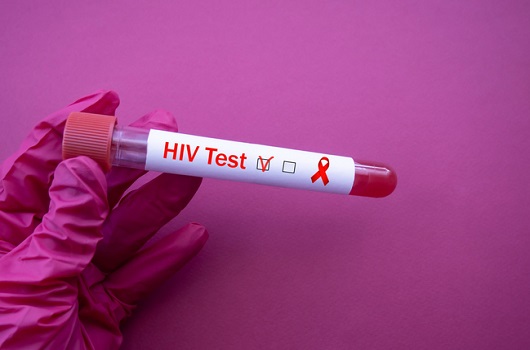 에이즈는 고혈압·당뇨 같은 만성질환...HIV와 함께 살기 가능