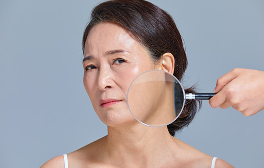 안면거상술은 얼굴을 당겨 처짐을 개선하는 수술이다 ｜출처: 게티이미지뱅크