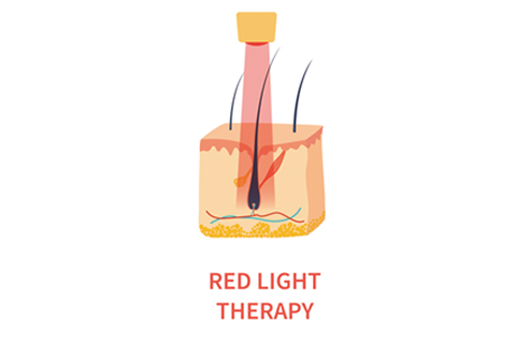 led 치료기기의 장점은 비침습적으로 탈모 관리가 가능하다는 것이다ㅣ출처: 게티이미지뱅크