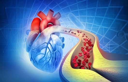 epa 제제의 심혈관질환 예방에 대한 연구 결과가 혼재돼 있다ㅣ출처: 게티이미지뱅크