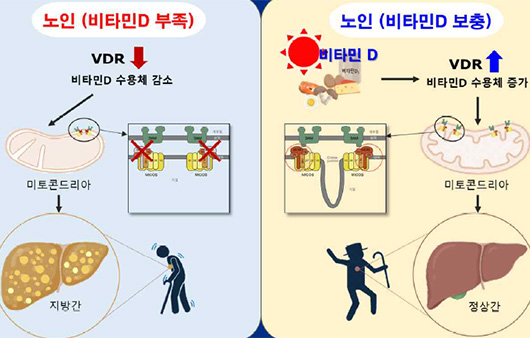 비타민 d와 노인성 지방간 사이의 연관성을 확인한 연구 결과 모식도 ｜출처: 질병관리청