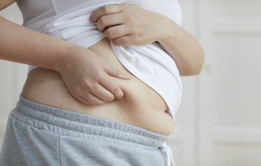 아무리 다이어트해도 살이 안 빠진다면?…비만 아닌 ‘이 병’ 의심