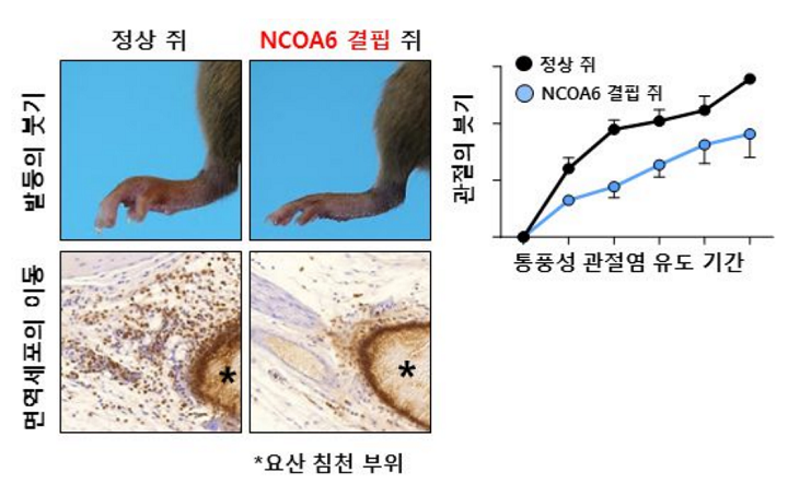 NCOA6 유전자가 결핍된 생쥐에서 통풍성 관절염이 감소 됨｜출처: 가톨릭중앙의료원