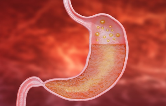 현대인에게 흔한 역류성 식도염, 각종 증상으로 삶의 질을 저하하기에 적극적 대처가 필요하다｜출처: 게티이미지뱅크