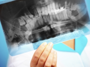 치아가 시린 증상이 심하다면? ‘치경부마모증’ 의심